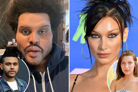 the weeknd plastic surgery bella hadid|the weeknd surgery video.